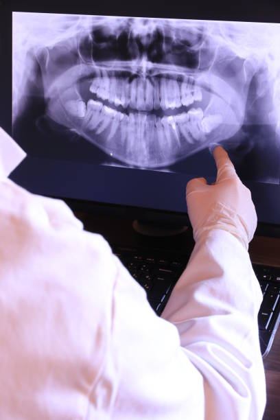 Best Emergency Root Canal Treatment in Lumberton, TX
